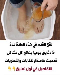 حل مشكله القدمين