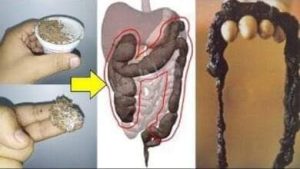 7طرق مجربه لتنظيف القولون